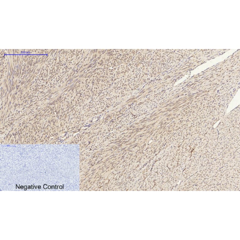 Immunohistochemistry - Anti-GRP78 Antibody (C0217) - Antibodies.com