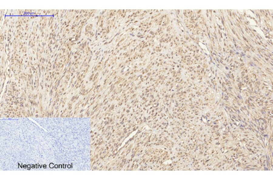 Immunohistochemistry - Anti-GRP78 Antibody (C0217) - Antibodies.com