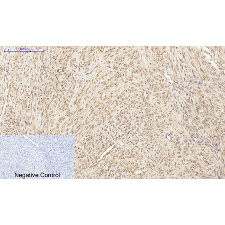 Immunohistochemistry - Anti-GRP78 Antibody (C0217) - Antibodies.com