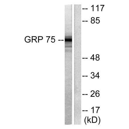 Western Blot - Anti-GRP75 Antibody (C0216) - Antibodies.com