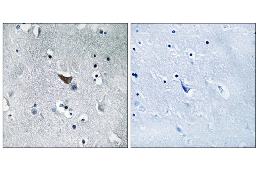 Immunohistochemistry - Anti-GluR1 Antibody (B7094) - Antibodies.com