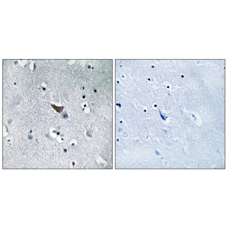 Immunohistochemistry - Anti-GluR1 Antibody (B7094) - Antibodies.com