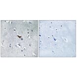 Immunohistochemistry - Anti-GluR1 Antibody (B7094) - Antibodies.com