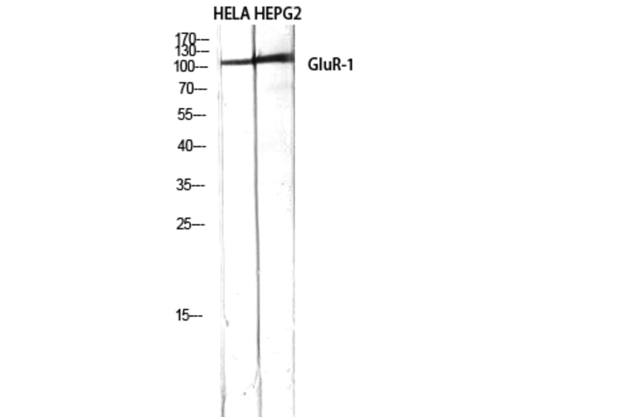 Western Blot - Anti-GluR1 Antibody (B7094) - Antibodies.com