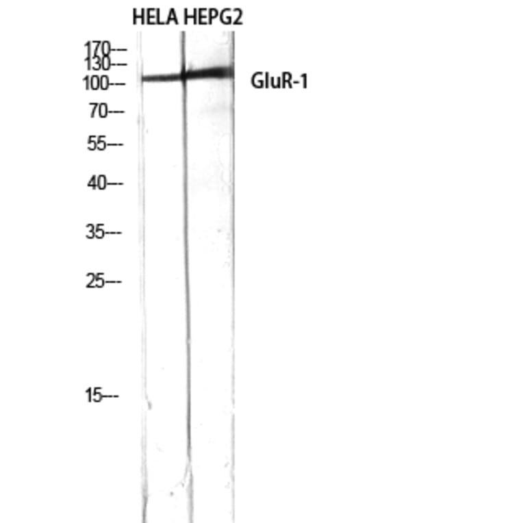Western Blot - Anti-GluR1 Antibody (B7094) - Antibodies.com