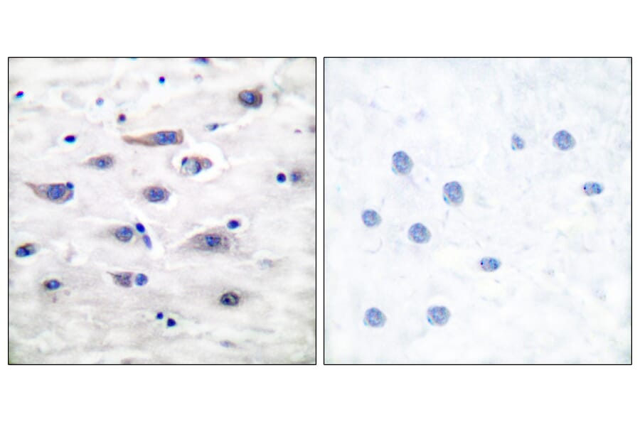 Immunohistochemistry - Anti-GluR1 Antibody (B7095) - Antibodies.com