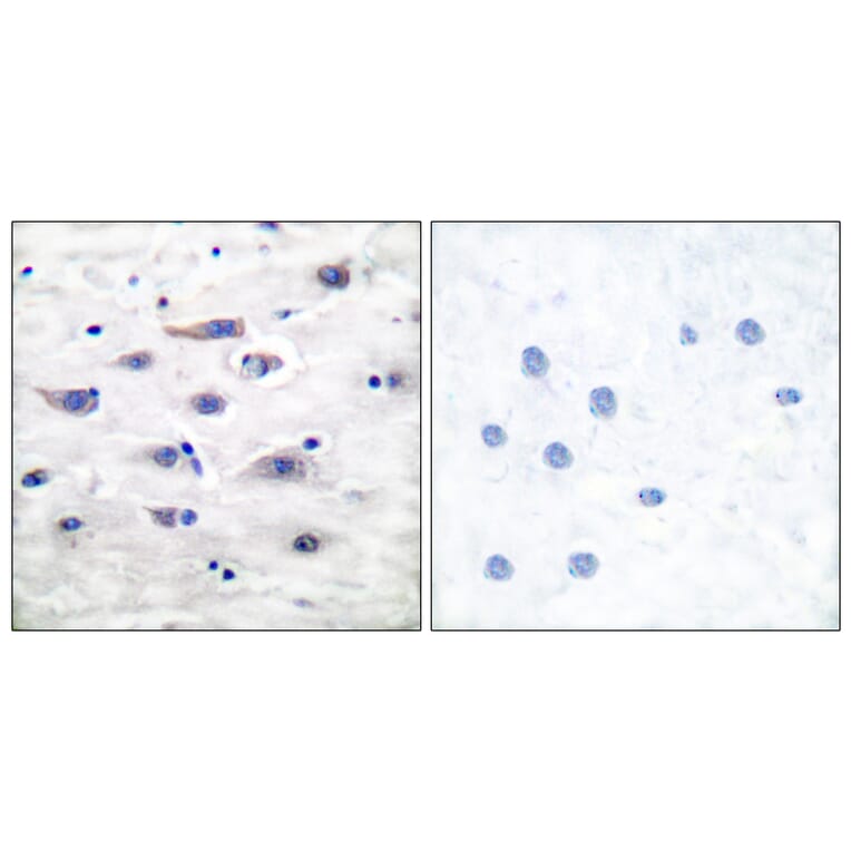 Immunohistochemistry - Anti-GluR1 Antibody (B7095) - Antibodies.com