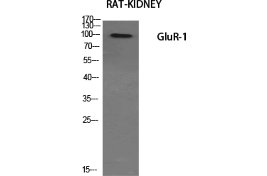 Western Blot - Anti-GluR1 Antibody (B7095) - Antibodies.com