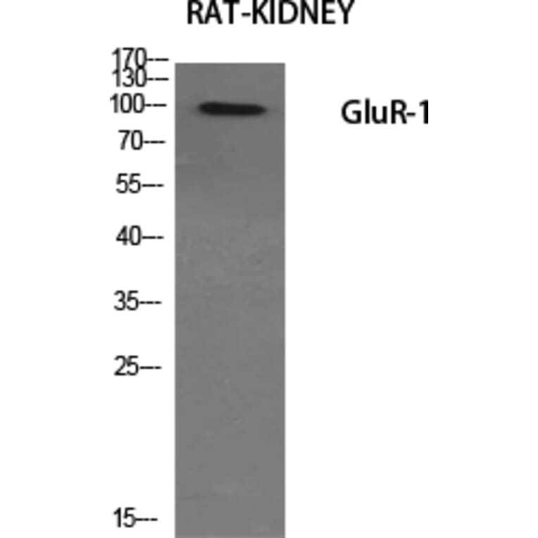Western Blot - Anti-GluR1 Antibody (B7095) - Antibodies.com