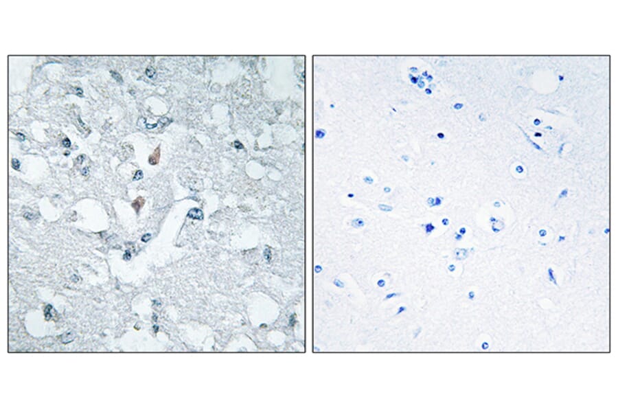 Immunohistochemistry - Anti-GLCTK Antibody (C11307) - Antibodies.com