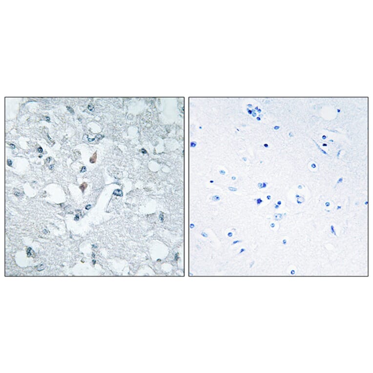 Immunohistochemistry - Anti-GLCTK Antibody (C11307) - Antibodies.com