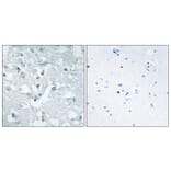Immunohistochemistry - Anti-GLCTK Antibody (C11307) - Antibodies.com