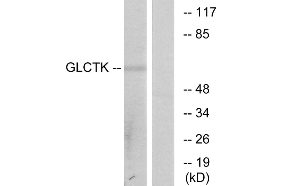 Western Blot - Anti-GLCTK Antibody (C11307) - Antibodies.com
