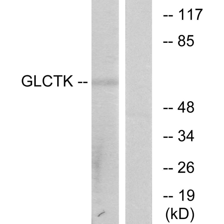 Western Blot - Anti-GLCTK Antibody (C11307) - Antibodies.com
