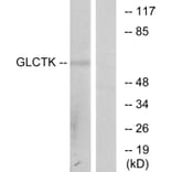 Western Blot - Anti-GLCTK Antibody (C11307) - Antibodies.com