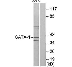 Western Blot - Anti-GATA1 Antibody (B7092) - Antibodies.com
