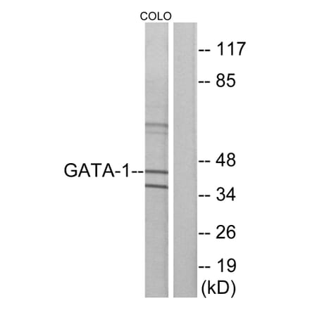 Western Blot - Anti-GATA1 Antibody (B7092) - Antibodies.com