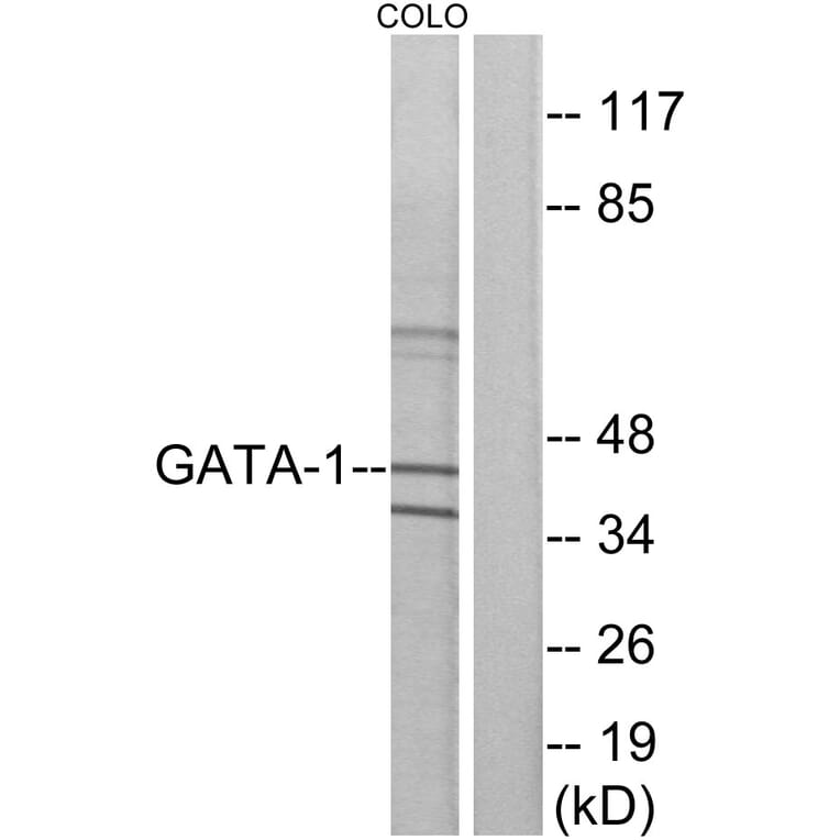 Western Blot - Anti-GATA1 Antibody (B7092) - Antibodies.com