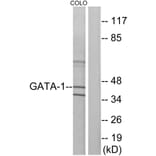 Western Blot - Anti-GATA1 Antibody (B7092) - Antibodies.com
