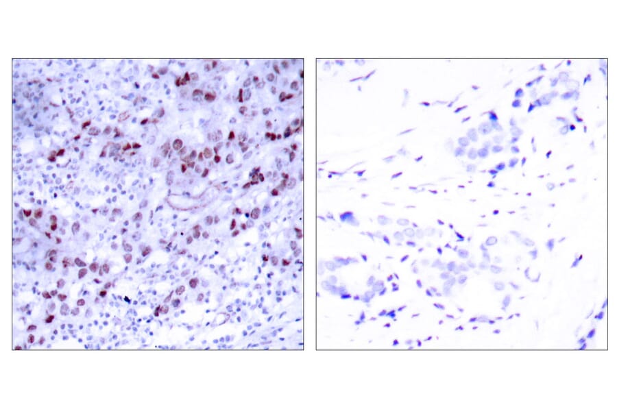 Immunohistochemistry - Anti-GATA1 Antibody (B7092) - Antibodies.com