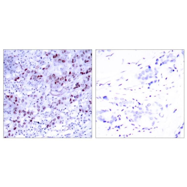 Immunohistochemistry - Anti-GATA1 Antibody (B7092) - Antibodies.com