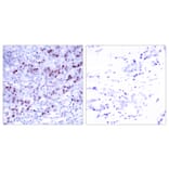 Immunohistochemistry - Anti-GATA1 Antibody (B7092) - Antibodies.com