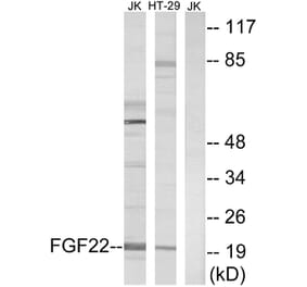 Western Blot - Anti-FGF22 Antibody (C12368) - Antibodies.com