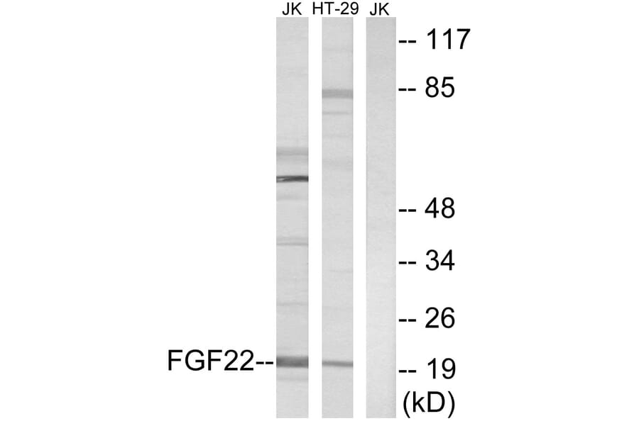 Western Blot - Anti-FGF22 Antibody (C12368) - Antibodies.com