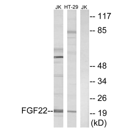 Western Blot - Anti-FGF22 Antibody (C12368) - Antibodies.com