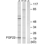 Western Blot - Anti-FGF22 Antibody (C12368) - Antibodies.com