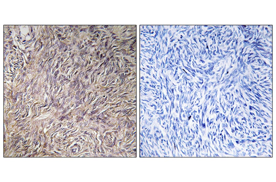 Immunohistochemistry - Anti-FGF22 Antibody (C12368) - Antibodies.com