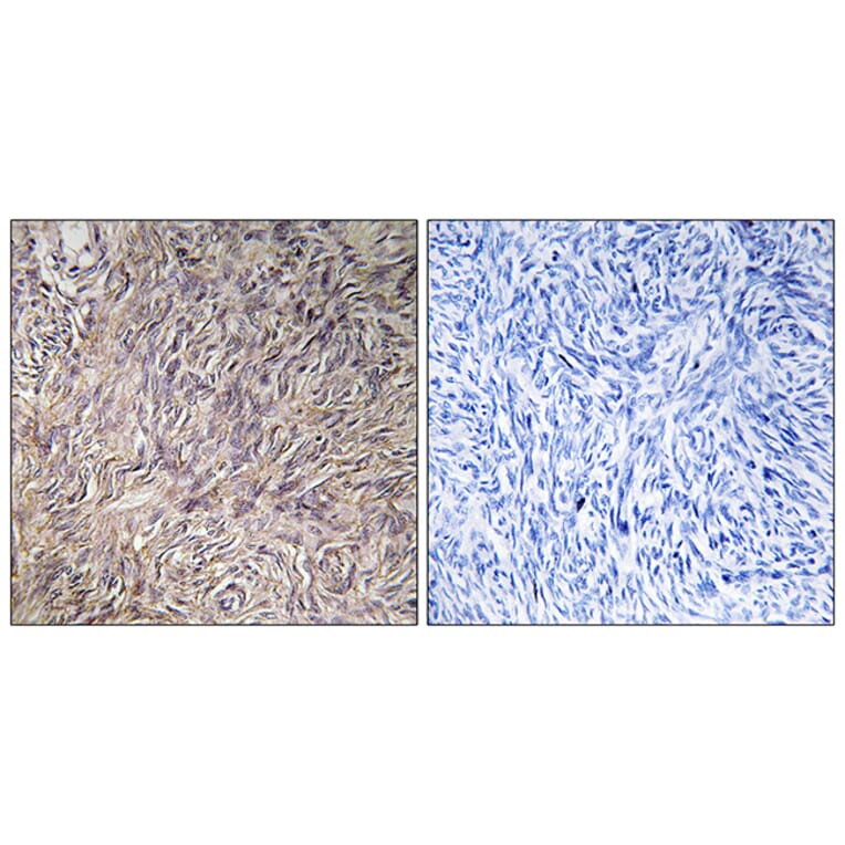 Immunohistochemistry - Anti-FGF22 Antibody (C12368) - Antibodies.com