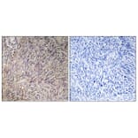 Immunohistochemistry - Anti-FGF22 Antibody (C12368) - Antibodies.com