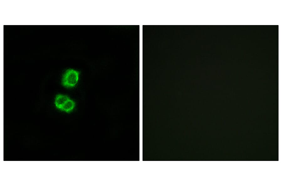 Immunofluorescence - Anti-FGF22 Antibody (C12368) - Antibodies.com