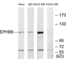 Western Blot - Anti-EPHB6 Antibody (C10075) - Antibodies.com
