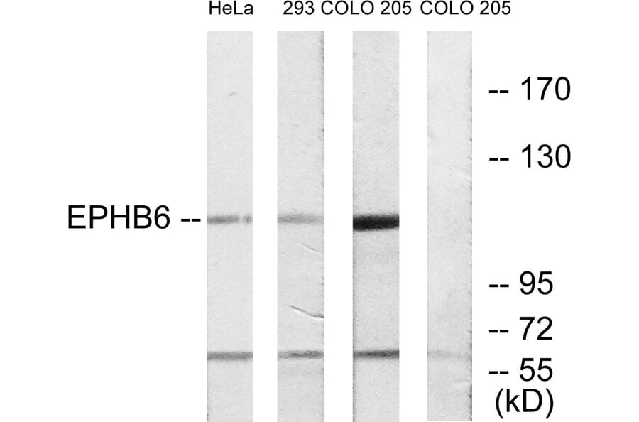 Western Blot - Anti-EPHB6 Antibody (C10075) - Antibodies.com