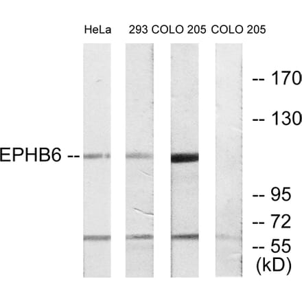 Western Blot - Anti-EPHB6 Antibody (C10075) - Antibodies.com