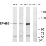 Western Blot - Anti-EPHB6 Antibody (C10075) - Antibodies.com