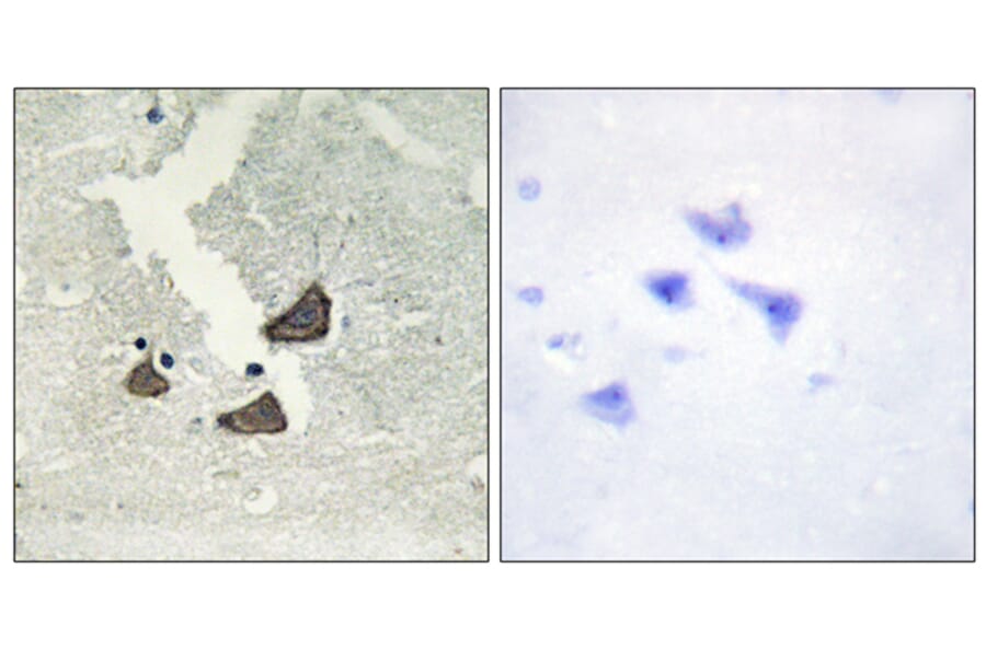 Immunohistochemistry - Anti-EPHB6 Antibody (C10075) - Antibodies.com