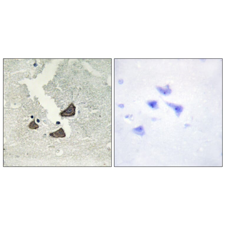 Immunohistochemistry - Anti-EPHB6 Antibody (C10075) - Antibodies.com