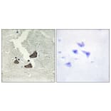 Immunohistochemistry - Anti-EPHB6 Antibody (C10075) - Antibodies.com