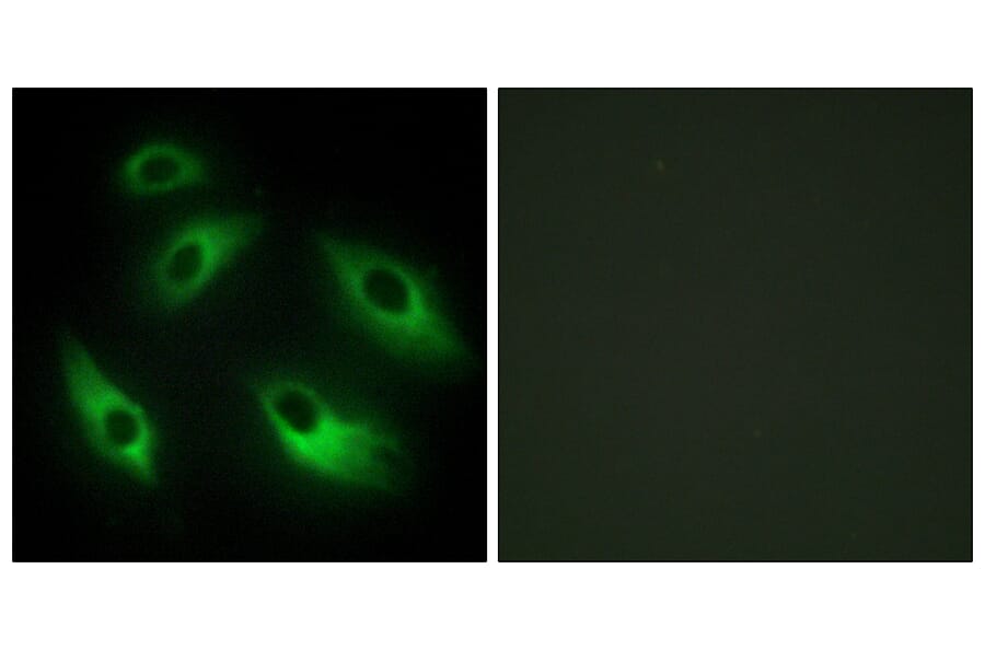 Immunofluorescence - Anti-EPHB6 Antibody (C10075) - Antibodies.com