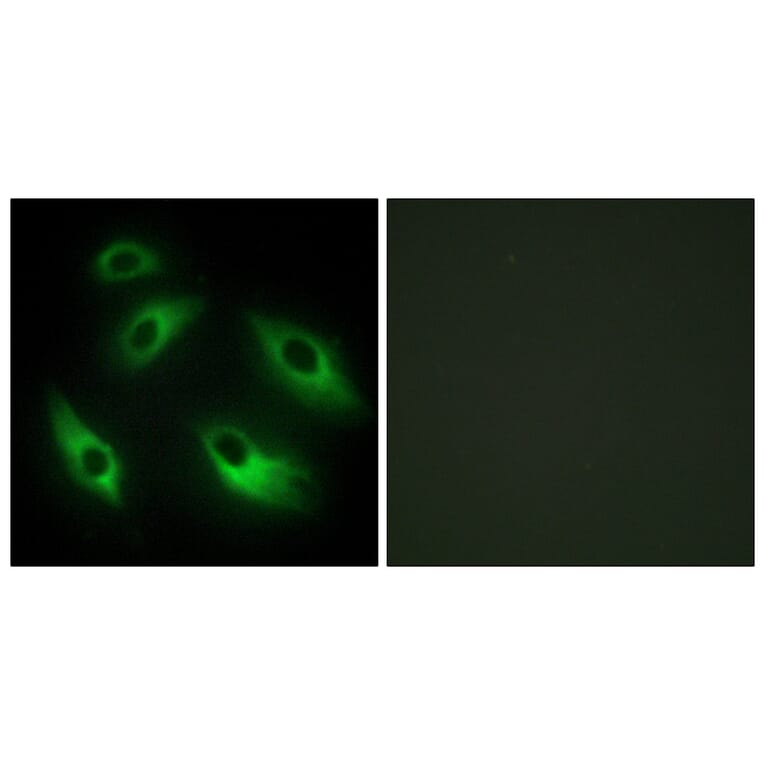 Immunofluorescence - Anti-EPHB6 Antibody (C10075) - Antibodies.com