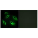 Immunofluorescence - Anti-EPHB6 Antibody (C10075) - Antibodies.com