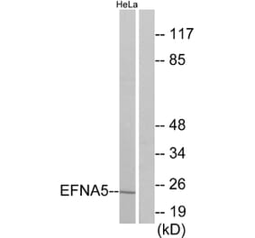 Western Blot - Anti-EFNA5 Antibody (C10712) - Antibodies.com