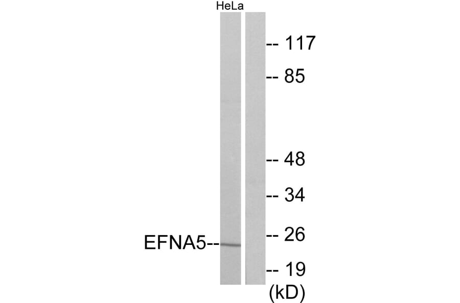 Western Blot - Anti-EFNA5 Antibody (C10712) - Antibodies.com