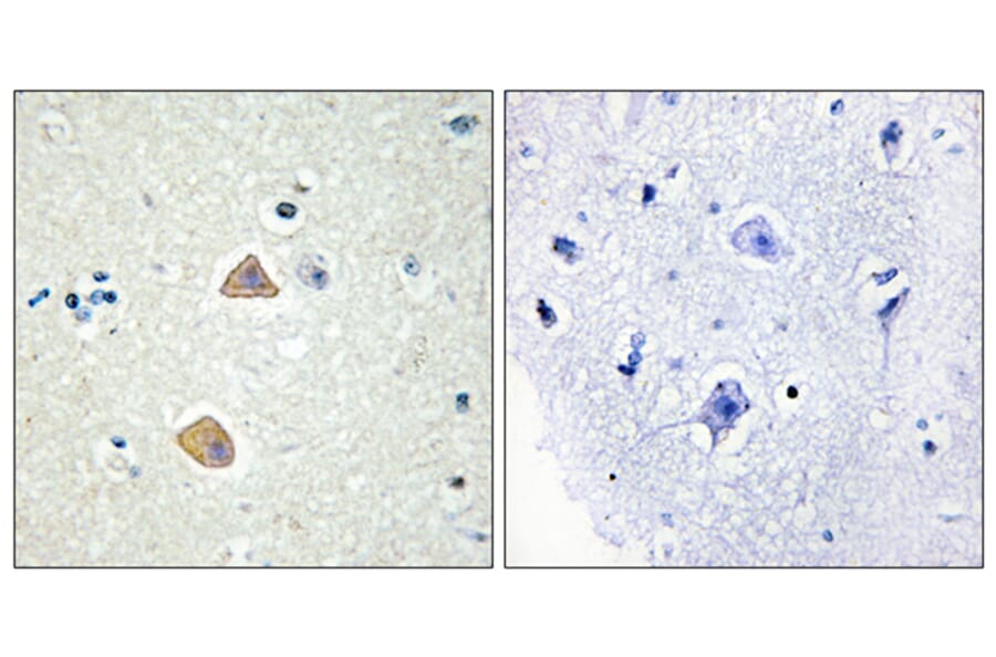 Immunohistochemistry - Anti-EFNA5 Antibody (C10712) - Antibodies.com