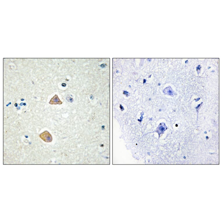 Immunohistochemistry - Anti-EFNA5 Antibody (C10712) - Antibodies.com
