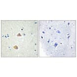 Immunohistochemistry - Anti-EFNA5 Antibody (C10712) - Antibodies.com