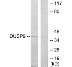Western Blot - Anti-DUSP9 Antibody (C11586) - Antibodies.com